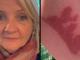 Caff&egrave; bollente in volo, ustioni e risarcimento: cosa non torna nella sicurezza dei voli low cost