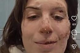 Strage Crans-Montana: Eleonora Palmieri si mostra sui social e rompe il silenzio sul rogo