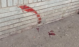 Torino, sangue in via Sempione e un uomo denunciato: &ldquo;Volevano rubare il cibo a un clochard&rdquo;