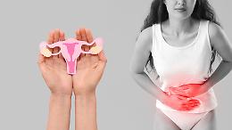 Endometriosi, malattia invisibile che colpisce 3 milioni di italiane: fino a 7 anni per una diagnosi