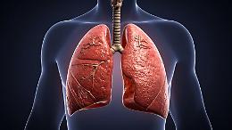 Tumore al polmone, al Mauriziano di Torino un nuovo modello cambia le cure
