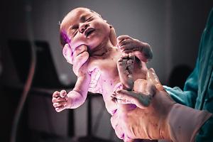 Torino, la tragedia del piccolo Tito, morto a 10 mesi dopo un errore chirurgico