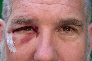 Ancora violenza in carcere: aggredito un agente a Torino