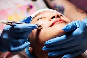 Adrenalina scaduta e punturine a rischio: Procura indaga su medico estetico del torinese