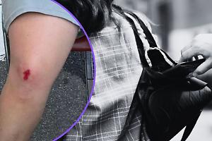 Torino, allarme aggressioni in monopattino: cittadini presi di mira