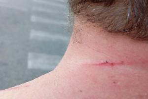 Gli strappa la collana d'oro e fugge in monopattino