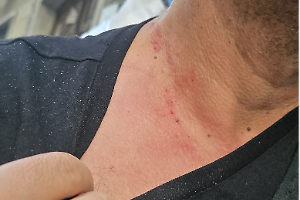 Torino fuori controllo: ragazzo aggredito e picchiato per una collana d’oro