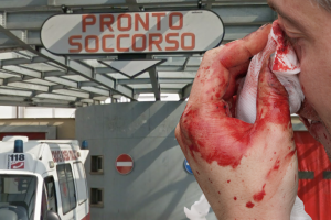 Dà in escandescenza in Pronto Soccorso, spacca il naso al medico e ferisce gli altri operatori