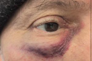 Aggressione shock al supermercato: cliente disabile aggredito senza motivo