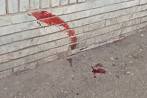 Torino, sangue in via Sempione e un uomo denunciato: “Volevano rubare il cibo a un clochard”