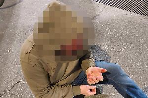 Rissa choc in corso Torino: uomo pestato a sangue, la denuncia