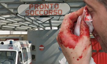 Dà in escandescenza in Pronto Soccorso, spacca il naso al medico e ferisce gli altri operatori