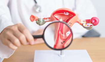 Castiglione Torinese, una panchina per dare voce al dolore invisibile dell’endometriosi