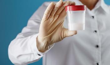 Scandalo della Banca dello sperma: il donatore “Kjeld” con mutazione TP53 e quasi 200 bambini a rischio tumore in 14 Paesi