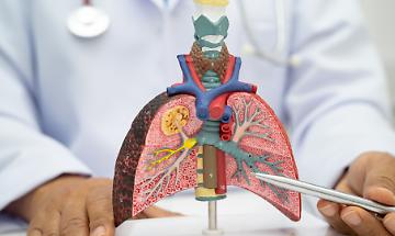 Svolta contro il tumore