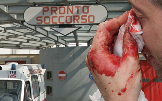 Dà in escandescenza in Pronto Soccorso, spacca il naso al medico e ferisce gli altri operatori