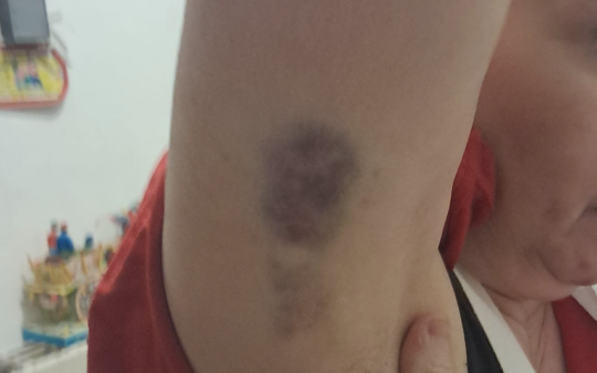 Afferrata e trascinata in corridoio: Medico aggredisce Oss all&rsquo;ospedale di Ivrea