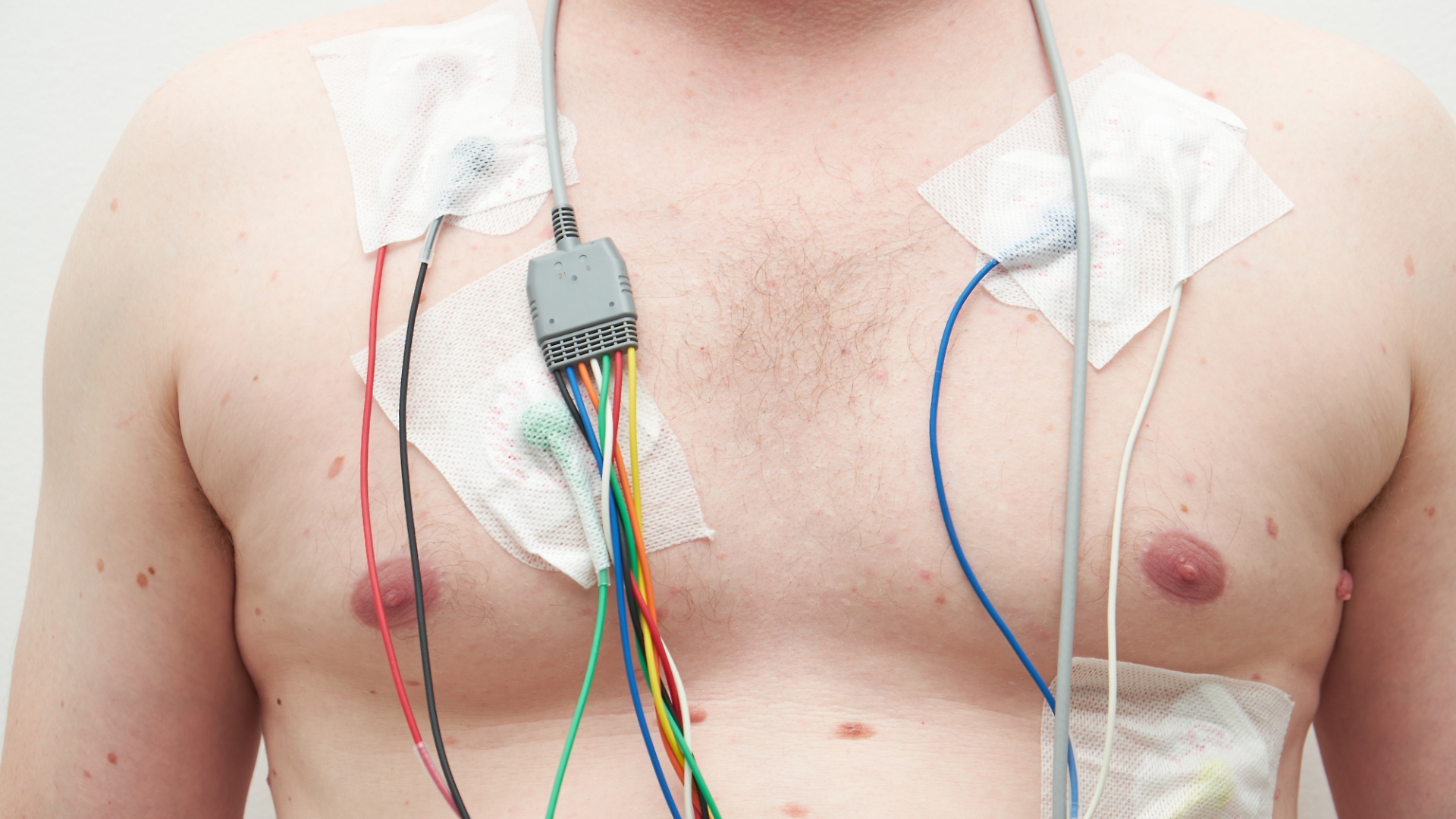 Holter cardiaco
