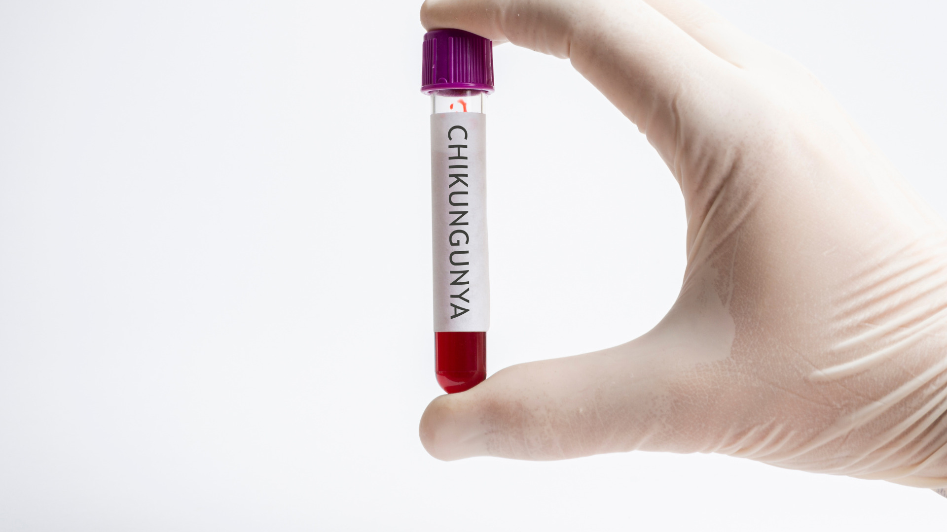 Chikungunya, dal 30 ottobre arriva in Italia il primo vaccino: una svolta contro il virus della zanzara tigre